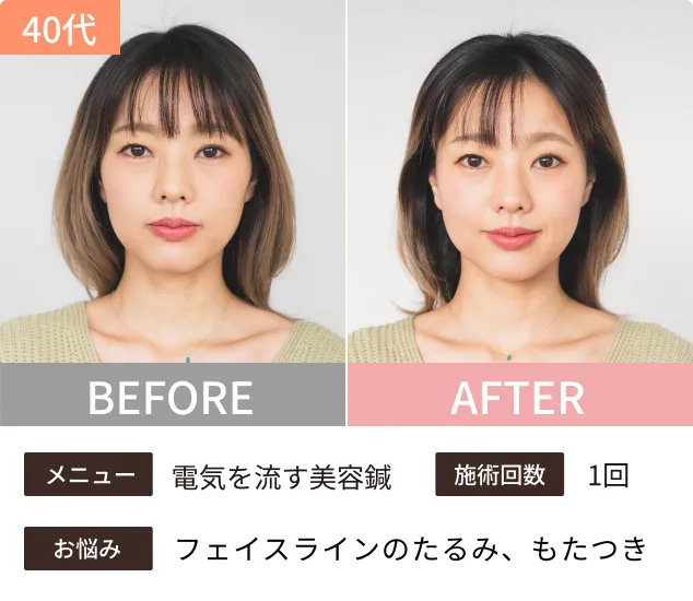 Before-After