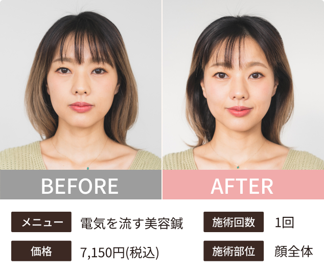 Before-After