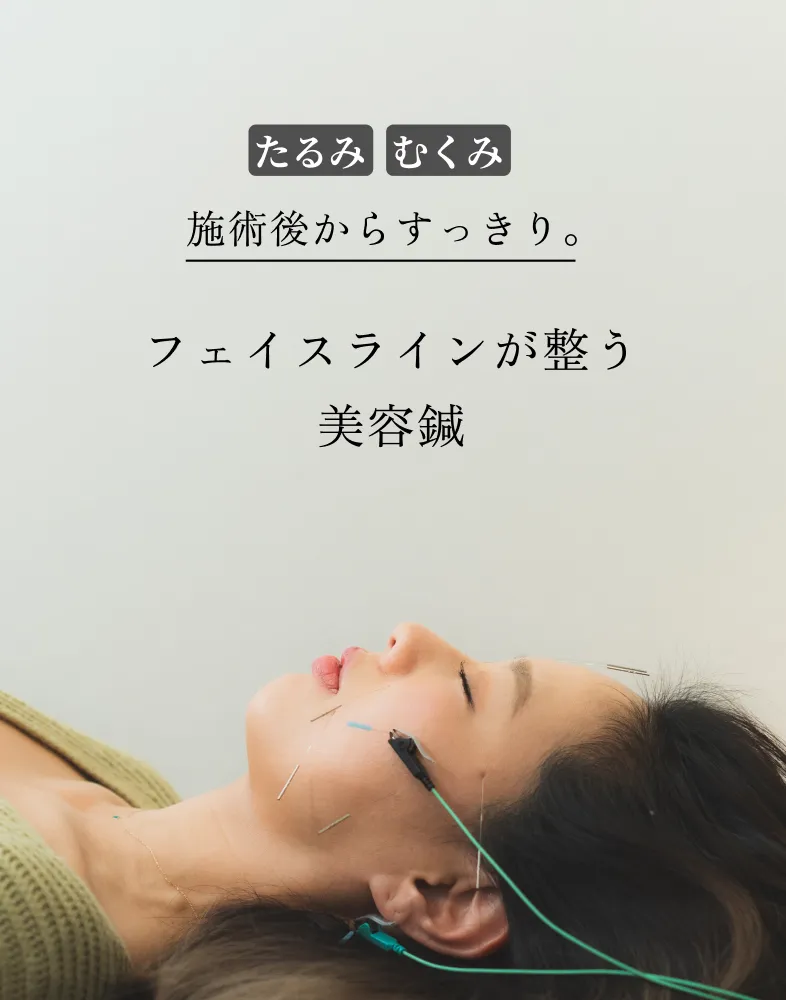 美容鍼で取り戻す小顔と美肌